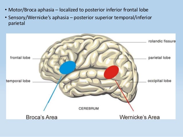 Motor Aphasia Symptoms - impremedia.net