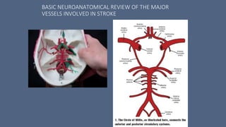 BASIC NEUROANATOMICAL REVIEW OF THE MAJOR
VESSELS INVOLVED IN STROKE
 