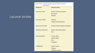 Lacunar stroke
 