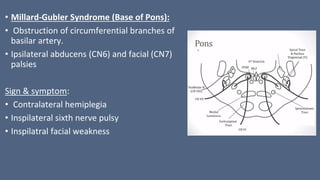 • Millard-Gubler Syndrome (Base of Pons):
• Obstruction of circumferential branches of
basilar artery.
• Ipsilateral abducens (CN6) and facial (CN7)
palsies
Sign & symptom:
• Contralateral hemiplegia
• Inspilateral sixth nerve pulsy
• Inspilatral facial weakness
 