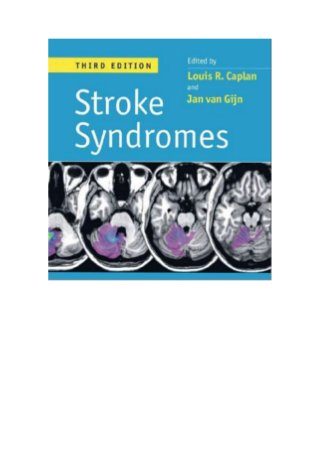Stroke syndromes clinical neurology