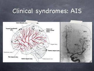 Clinical syndromes: AIS
 