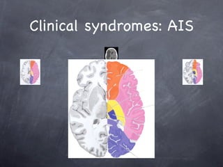 Clinical syndromes: AIS
 