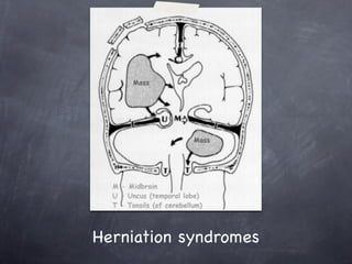 Herniation syndromes
 