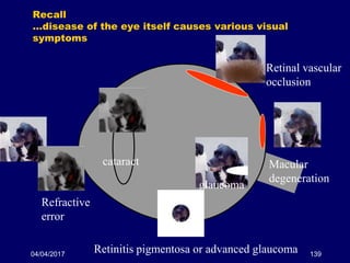 04/04/2017 139
Recall
…disease of the eye itself causes various visual
symptoms
cataract
glaucoma
Retinitis pigmentosa or advanced glaucoma
Macular
degeneration
Retinal vascular
occlusion
Refractive
error
 