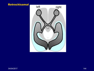 04/04/2017 144
Retrochisamal
 