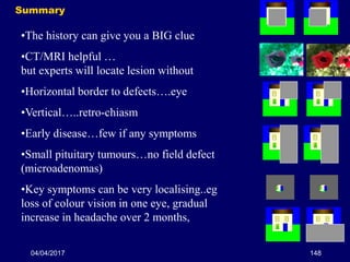 04/04/2017 148
Summary
•The history can give you a BIG clue
•CT/MRI helpful …
but experts will locate lesion without
•Horizontal border to defects….eye
•Vertical…..retro-chiasm
•Early disease…few if any symptoms
•Small pituitary tumours…no field defect
(microadenomas)
•Key symptoms can be very localising..eg
loss of colour vision in one eye, gradual
increase in headache over 2 months,
 