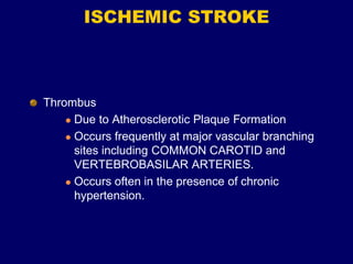 ISCHEMIC STROKE
Thrombus
 Due to Atherosclerotic Plaque Formation
 Occurs frequently at major vascular branching
sites including COMMON CAROTID and
VERTEBROBASILAR ARTERIES.
 Occurs often in the presence of chronic
hypertension.
 