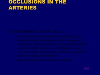 OCCLUSIONS IN THE
ARTERIES
 