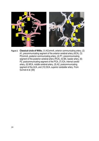 24
Figure 2. Classical circle of Willis. (1) ACommA, anterior communicating artery, (2)
A1, precommunicating segment of the anterior cerebral artery (ACA), (3)
PCommA, posterior communicating artery, (4) P1, precommunicating
segment of the posterior cerebral artery (PCA), (5) BA, basilar artery, (6)
P2, postcommunicating segment of the PCA, (7) ICA, internal carotid
artery, (8) MCA, middle cerebral artery, (9) A2, postcommunicating
segment of the ACA, and (10) SCA, superior cerebellar artery. From
Gunnal et al. [55]
 