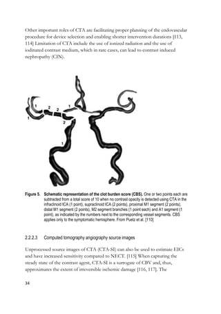 34
Other important roles of CTA are facilitating proper planning of the endovascular
procedure for device selection and enabling shorter intervention durations [113,
114] Limitation of CTA include the use of ionized radiation and the use of
iodinated contrast medium, which in rare cases, can lead to contrast induced
nephropathy (CIN).
Figure 5. Schematic representation of the clot burden score (CBS). One or two points each are
subtracted from a total score of 10 when no contrast opacity is detected using CTA in the
infraclinoid ICA (1 point), supraclinoid ICA (2 points), proximal M1 segment (2 points),
distal M1 segment (2 points), M2 segment branches (1 point each) and A1 segment (1
point), as indicated by the numbers next to the corresponding vessel segments. CBS
applies only to the symptomatic hemisphere. From Puetz et al. [110]
2.2.2.3 Computed tomography angiography source images
Unprocessed source images of CTA (CTA-SI) can also be used to estimate EICs
and have increased sensitivity compared to NECT. [115] When capturing the
steady state of the contrast agent, CTA-SI is a surrogate of CBV and, thus,
approximates the extent of irreversible ischemic damage [116, 117]. The
 