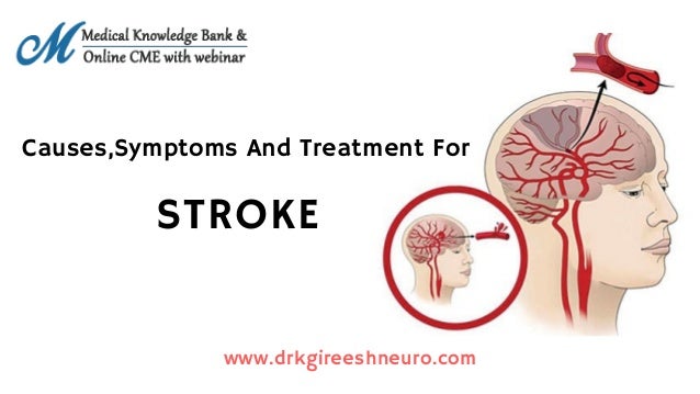 Stroke Treatment in Chennai | Neurosurgeon In India