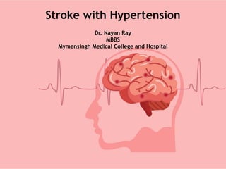 Stroke with Hypertension
Dr. Nayan Ray
MBBS
Mymensingh Medical College and Hospital
 