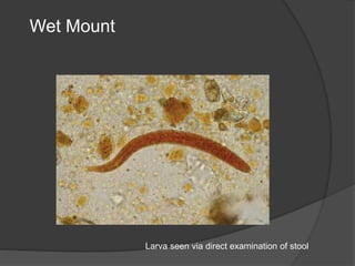 Wet Mount
Larva seen via direct examination of stool
 