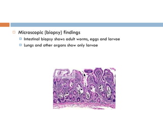 Microscopic (biopsy) findings Intestinal biopsy shows adult worms, eggs and larvae Lungs and other organs show only larvae 