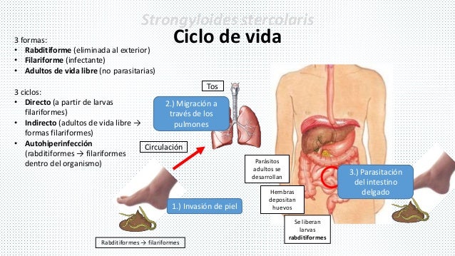 Resultado de imagen para sintomas de la strongyloidiasis