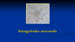 Strongyloides stercoralis
 