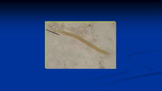 Strongyloides stercoralis