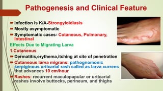 Strongyloides stercoralis | PPTX