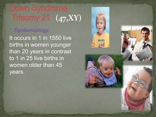 * Epidemiology:
It occurs in 1 in 1550 live
births in women younger
than 20 years in contrast
to 1 in 25 live births in
women older than 45
years.
 