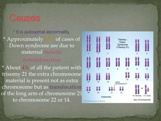 * It is autosomal abnormality.
* Approximately 95% of cases of
Down syndrome are due to
maternal meiotic
nondisjunction.
* About 4% of all the patient with
trisomy 21 the extra chromosome
material is present not as extra
chromosome but as translocation
of the long arm of chromosome 21
to chromosome 22 or 14.
 