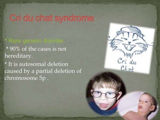 * Rare genetic disorder.
* 90% of the cases is not
hereditary.
* It is autosomal deletion
caused by a partial deletion of
chromosome 5p .
 