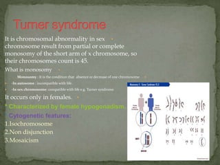 •It is chromosomal abnormality in sex
chromosome result from partial or complete
monosomy of the short arm of x chromosome, so
their chromosomes count is 45.
•What is monosomy
Monosomy : It is the condition that absence or decrease of one chromosome
 -In autosome : incompatible with life.
 -In sex chromosome: compatible with life e.g. Turner syndrome
•It occurs only in females.
* Characterized by female hypogonadism.
* Cytogenetic features:
1.Isochromosome
2.Non disjunction
3.Mosaicism
 