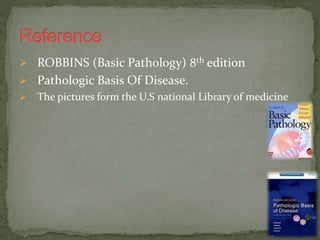  ROBBINS (Basic Pathology) 8th edition
 Pathologic Basis Of Disease.
 The pictures form the U.S national Library of medicine
 
