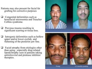 Patients may also present for facial fat
grafting for corrective purposes
 Congenital deformities such as
hemifacial microsomia and Treacher
Collins syndrome.
 Previous trauma resulting in
significant scarring or tissue loss.
 Iatrogenic deformities such as hollow
upper and/or lower eyelids and
flattening of the posterior jaw line.
 Facial atrophy from etiologies other
than aging , especially drug related
lipodystrophy seen in patients taking
antiretroviral and protease inhibitor
therapies.
 
