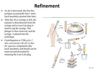 Refinement
 As fat is harvested, the first few
syringes occasionally have more
local anesthetic present than later.
 After the 10 cc syringe is full, the
cannula is disconnected from the
syringe and a Luer-Lok plug is
used to cap the syringe. The
plunger is then removed, and the
syringe is placed into the
centrifuge.
 Centrifugation at 1286 g for 2
min concentrates the fat so that
the aqueous components (the
local anesthetic and blood) can be
removed and discarded by
releasing the Luer-Lok plug.
 