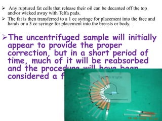  Any ruptured fat cells that release their oil can be decanted off the top
and/or wicked away with Telfa pads.
 The fat is then transferred to a 1 cc syringe for placement into the face and
hands or a 3 cc syringe for placement into the breasts or body.
The uncentrifuged sample will initially
appear to provide the proper
correction, but in a short period of
time, much of it will be reabsorbed
and the procedure will have been
considered a failure
 