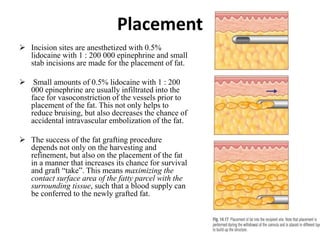 Placement
 Incision sites are anesthetized with 0.5%
lidocaine with 1 : 200 000 epinephrine and small
stab incisions are made for the placement of fat.
 Small amounts of 0.5% lidocaine with 1 : 200
000 epinephrine are usually infiltrated into the
face for vasoconstriction of the vessels prior to
placement of the fat. This not only helps to
reduce bruising, but also decreases the chance of
accidental intravascular embolization of the fat.
 The success of the fat grafting procedure
depends not only on the harvesting and
refinement, but also on the placement of the fat
in a manner that increases its chance for survival
and graft “take”. This means maximizing the
contact surface area of the fatty parcel with the
surrounding tissue, such that a blood supply can
be conferred to the newly grafted fat.
 