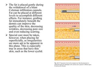  The fat is placed gently during
the withdrawal of a blunt
Coleman infiltration cannula.
Fat can be placed at different
levels to accomplish different
effects. For instance, grafting
fat immediately beneath the
dermis can improve the
quality of the skin, decreasing
wrinkles, decreasing pore size
and even reducing scarring.
 Special care must be taken,
however, when placing fat
superficially, as irregularities
are more apt to be apparent in
this plane. This is especially
true in areas that have thin
skin, such as the lower eyelid.
 