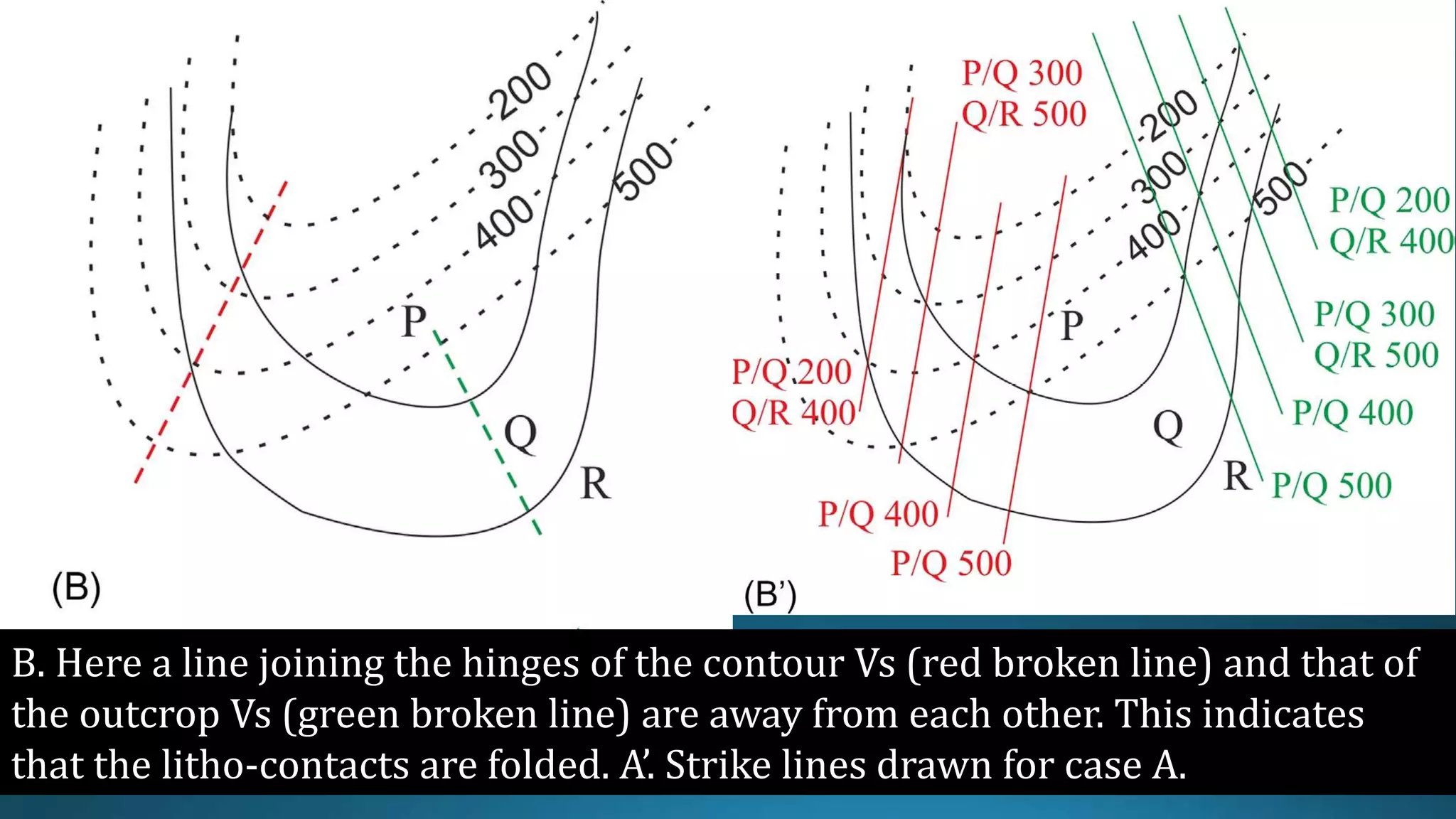 B. Here a line joining the hinges of the contour Vs (red broken line) and that of
the outcrop Vs (green broken line) are away from each other. This indicates
that the litho-contacts are folded. A’. Strike lines drawn for case A.
 
