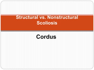 Cordus
Structural vs. Nonstructural
Scoliosis
 