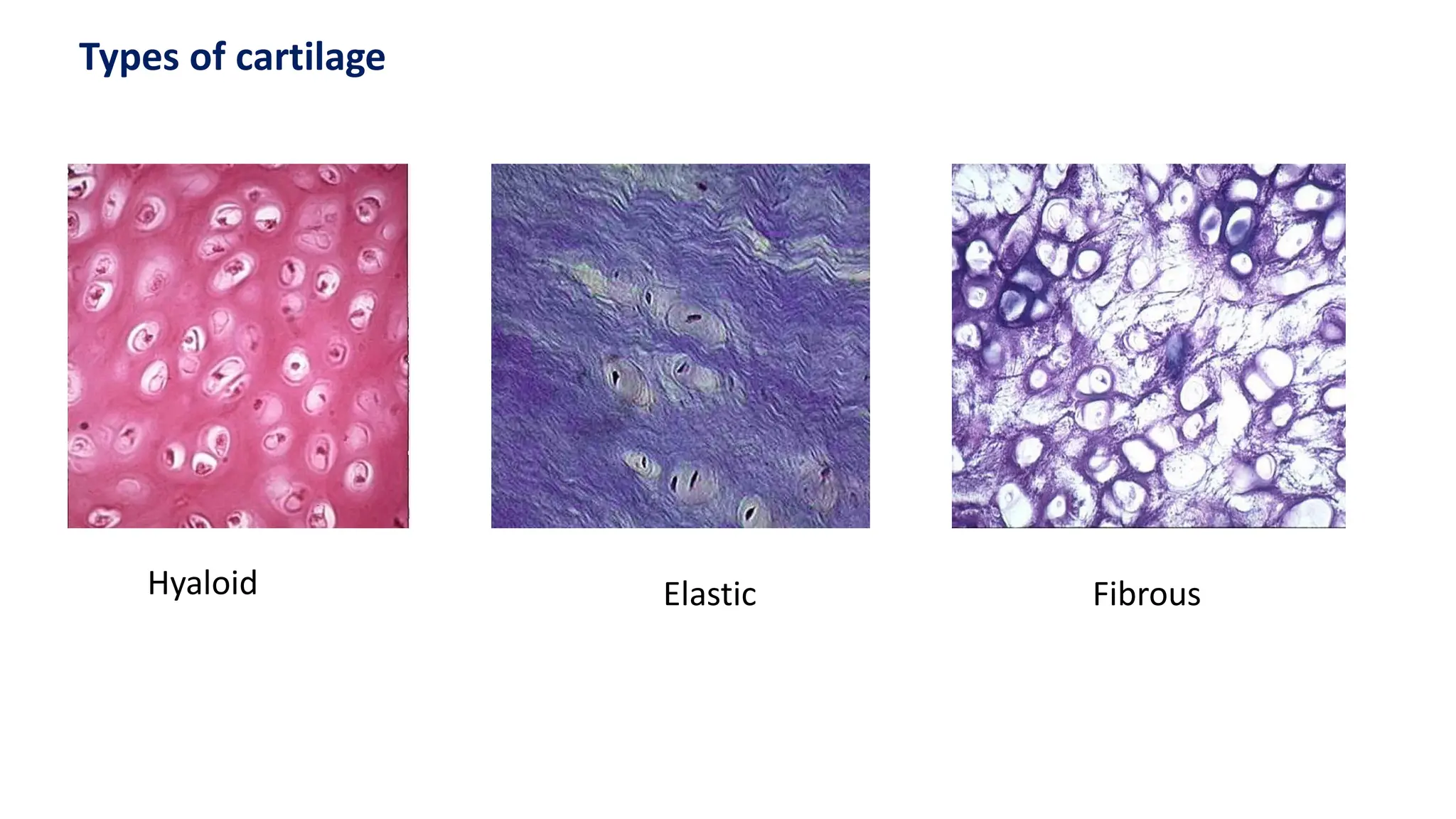 Types of cartilage
Hyaloid Elastic Fibrous
 