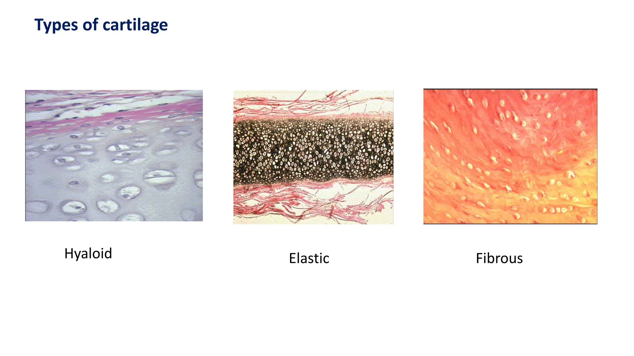 Types of cartilage
Hyaloid Elastic Fibrous
 