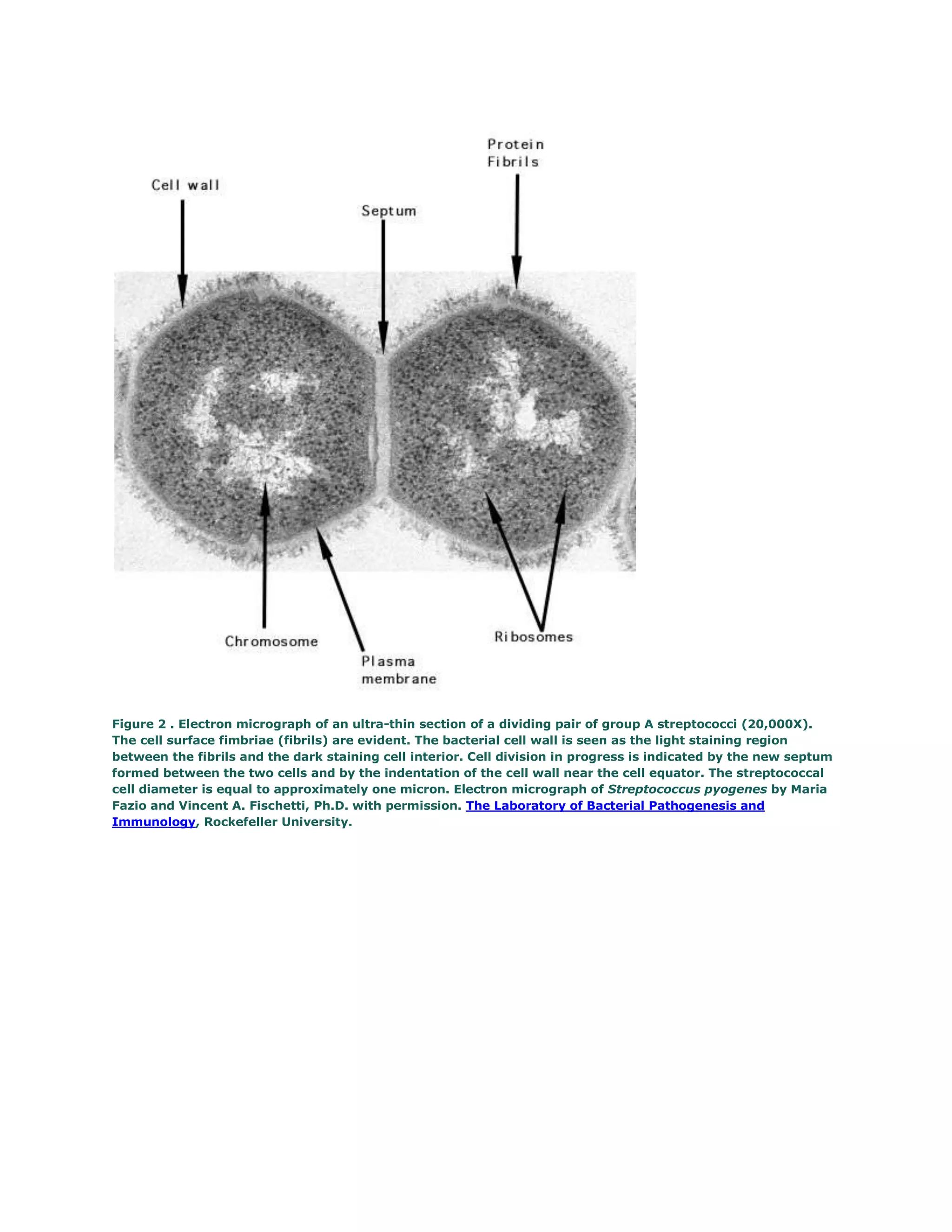 Figure 2 . Electron micrograph of an ultra-thin section of a dividing pair of group A streptococci (20,000X).
The cell surface fimbriae (fibrils) are evident. The bacterial cell wall is seen as the light staining region
between the fibrils and the dark staining cell interior. Cell division in progress is indicated by the new septum
formed between the two cells and by the indentation of the cell wall near the cell equator. The streptococcal
cell diameter is equal to approximately one micron. Electron micrograph of Streptococcus pyogenes by Maria
Fazio and Vincent A. Fischetti, Ph.D. with permission. The Laboratory of Bacterial Pathogenesis and
Immunology, Rockefeller University.
 
