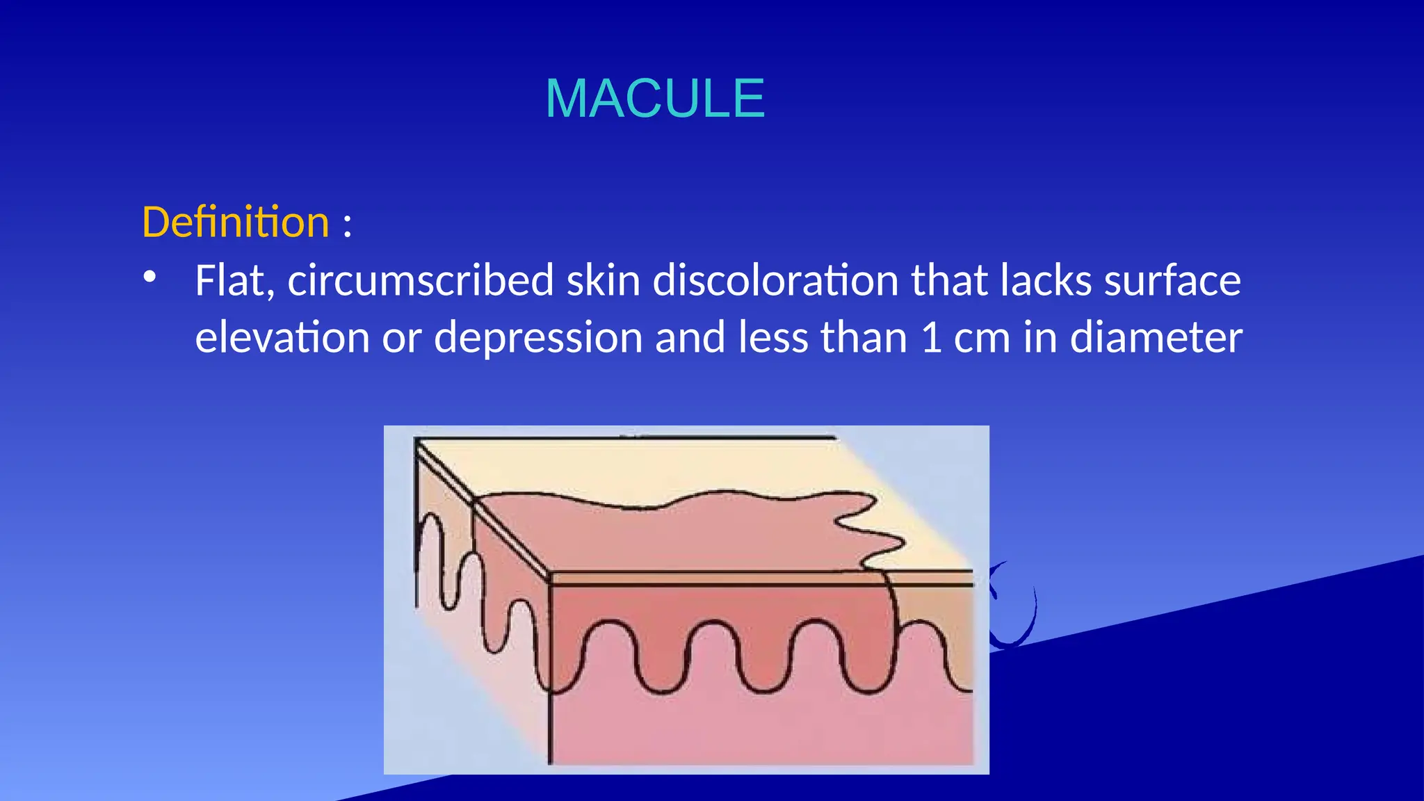 MACULE
Definition :
• Flat, circumscribed skin discoloration that lacks surface
elevation or depression and less than 1 cm in diameter
 
