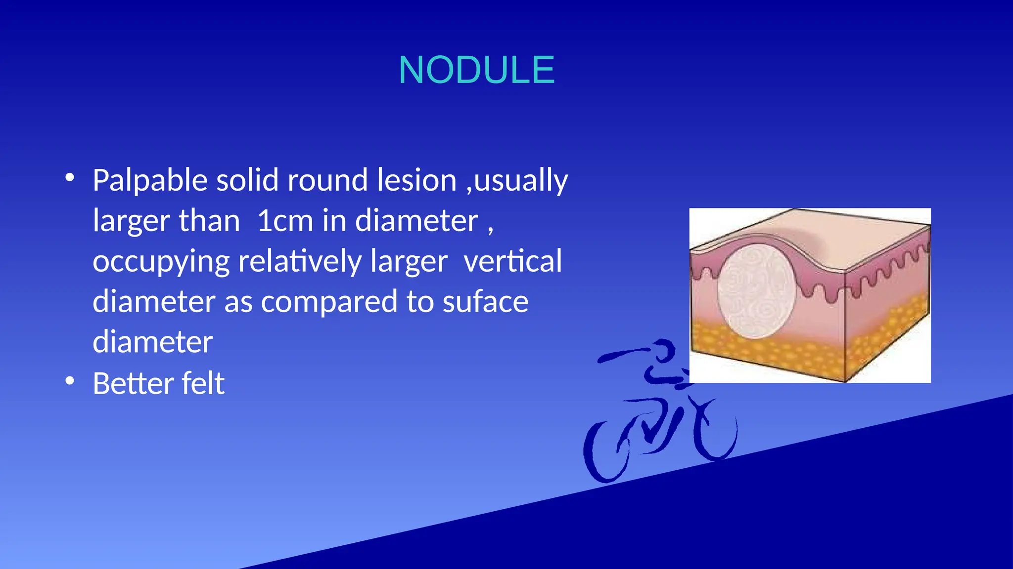 NODULE
• Palpable solid round lesion ,usually
larger than 1cm in diameter ,
occupying relatively larger vertical
diameter as compared to suface
diameter
• Better felt
 