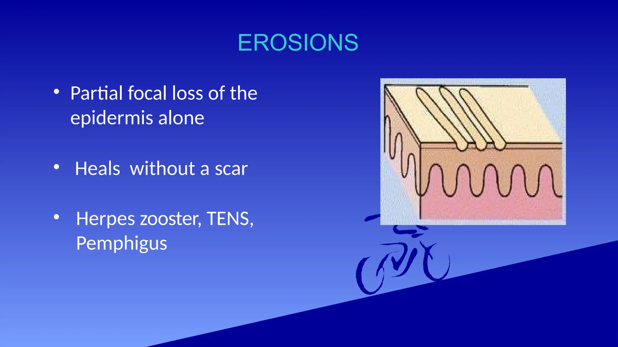 EROSIONS
• Partial focal loss of the
epidermis alone
• Heals without a scar
• Herpes zooster, TENS,
Pemphigus
 
