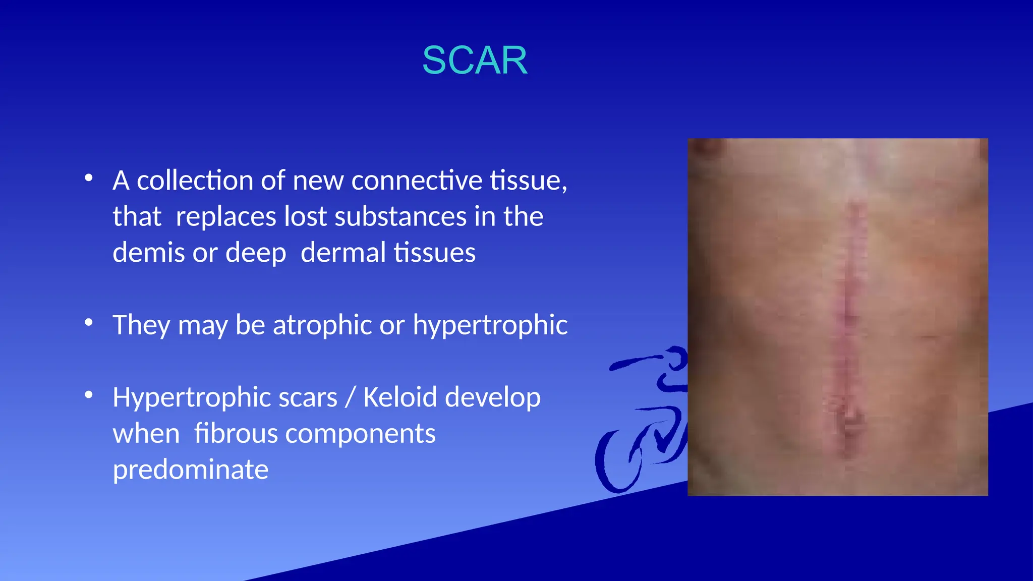 SCAR
• A collection of new connective tissue,
that replaces lost substances in the
demis or deep dermal tissues
• They may be atrophic or hypertrophic
• Hypertrophic scars / Keloid develop
when fibrous components
predominate
 