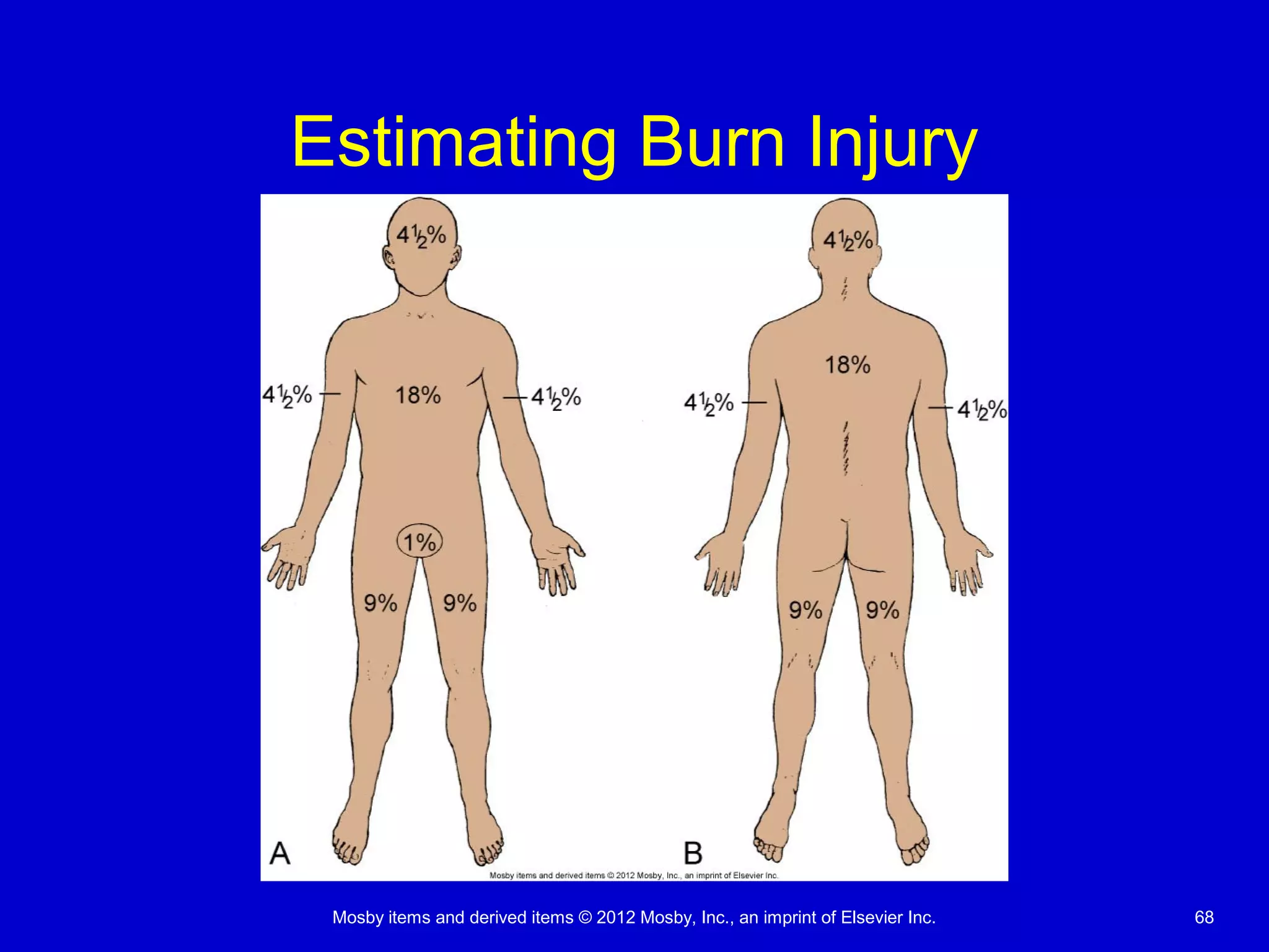 Mosby items and derived items © 2012 Mosby, Inc., an imprint of Elsevier Inc. 68
Estimating Burn Injury
 