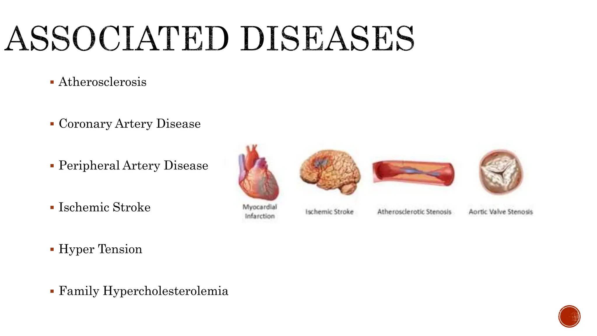  Atherosclerosis
 Coronary Artery Disease
 Peripheral Artery Disease
 Ischemic Stroke
 Hyper Tension
 Family Hypercholesterolemia
 
