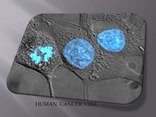 HUMAN CANCER CELL
 