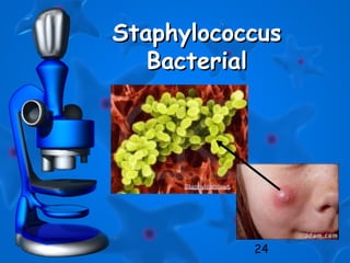 24
StaphylococcusStaphylococcus
BacterialBacterial
 