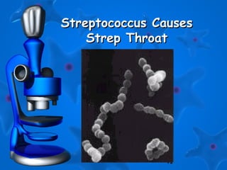 41
Streptococcus CausesStreptococcus Causes
Strep ThroatStrep Throat
 