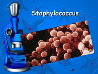 42
StaphylococcusStaphylococcus
 