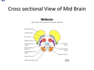 Cross sectional View of Mid Brain
Radiopaedia
Midbrain | Radiology Reference Article | Radiopaedia.org
 