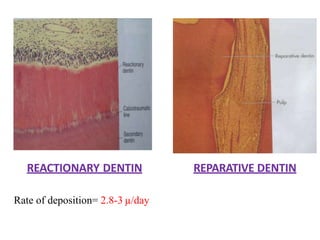 Structure of dentine | PPTX